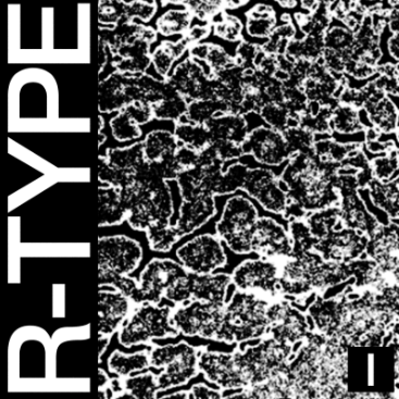 HEALTH lanza su esperado EP, R-TYPE 1